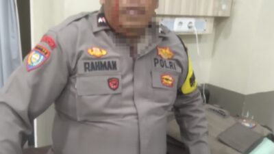 Bubarkan Tawuran di Belawan, Mata Kanan Aipda Abdul Rahman Buta Terkena Lemparan Batu