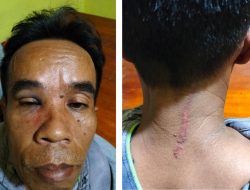 Dikeroyok 5 Orang Usai Cekcok Dengan Andi Pasaribu Anggota DPRD Dairi, Penarik Beca Minta Perlindungan Kepada Kapolda