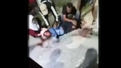 Cekcok di Dalam Rumah, Ibu Muda Dibacoki Suami di Asahan