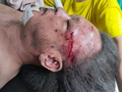 Wartawan Nico Saragih Tewas Mengenaskan, Diduga Dibantai di Kamar Kos Jalan PWS Medan