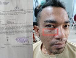Dianiaya 2 Preman, Ersada Gurusinga Lapor ke Polsek Pancur Batu