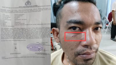 Dianiaya 2 Preman, Ersada Gurusinga Lapor ke Polsek Pancur Batu