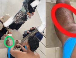 Baru Diresmikan, Kolam Renang Pemko Tebingtinggi ‘Makan’ Korban! 2 Kali Pengunjung Alami Kecelakaan