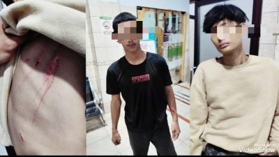 Dua Pelajar Binjai Korban Keganasan Gemot, Disabet Sajam dan Dianiaya