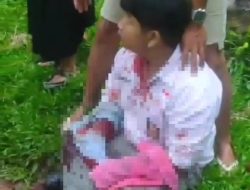 Siswa SMAN 5 Binjai Dibacok Brutal Saat Berangkat Sekolah di Titi Baru Berngam, Polres Binjai Kejar Komplotan Begal