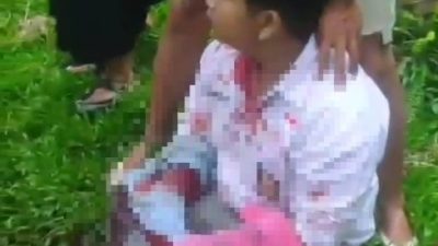 Siswa SMAN 5 Binjai Dibacok Brutal Saat Berangkat Sekolah di Titi Baru Berngam, Polres Binjai Kejar Komplotan Begal