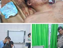 Laga Kambing di Jalan Pelita Medan Perjuangan, Dua Pengendara Motor Tewas