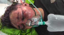 Pelaku Curanmor Ini Setengah Mati Dikeroyok Warga di STM Hilir