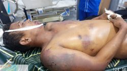 Diduga Dianiaya Usai Ditangkap Curi Besi di Area PTPN I Tamora, Daniel Situmeang Tewas, Keluarga Lapor Polisi